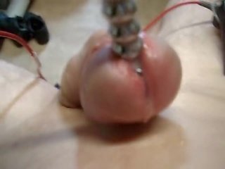 Electro ejaculações estimulação ejac electrotes sounding putz e cu